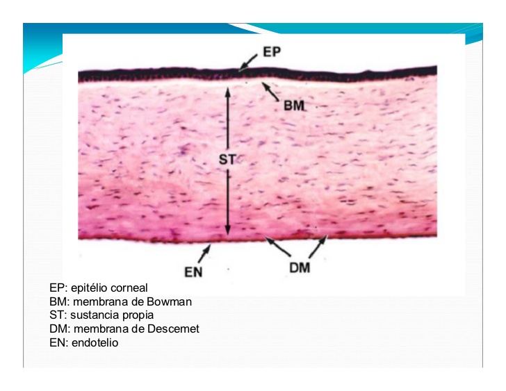 EP: epitélio corneal
BM: membrana de Bowman
ST: sustancia propia
DM: membrana de Descemet
EN: endotelio
 